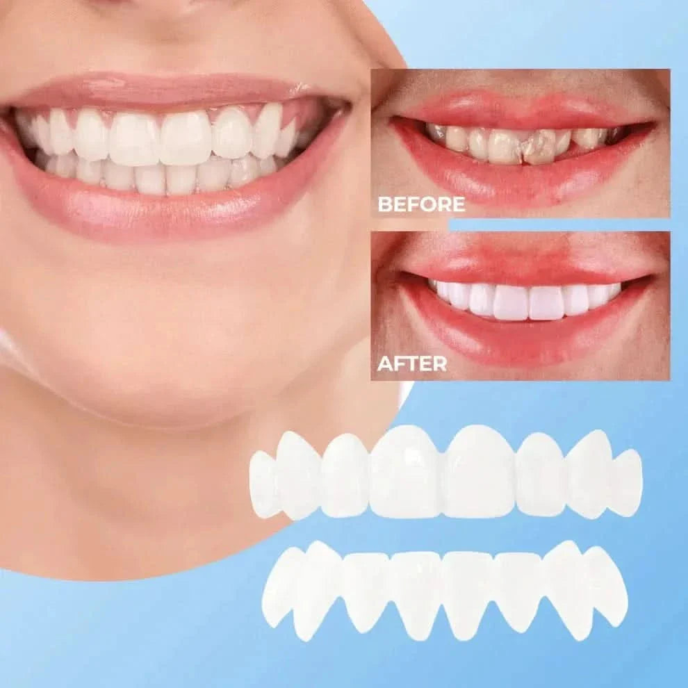 Lonryd - SmileFlex (50% OFF)