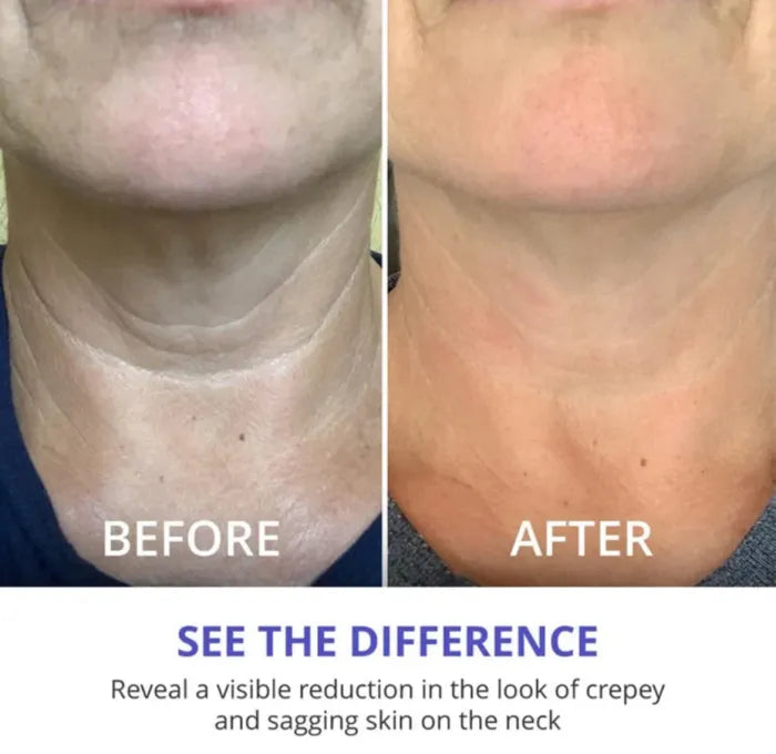RadiantLift - Tighten Neck Cream (50% OFF)